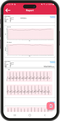 Digital ECG Report