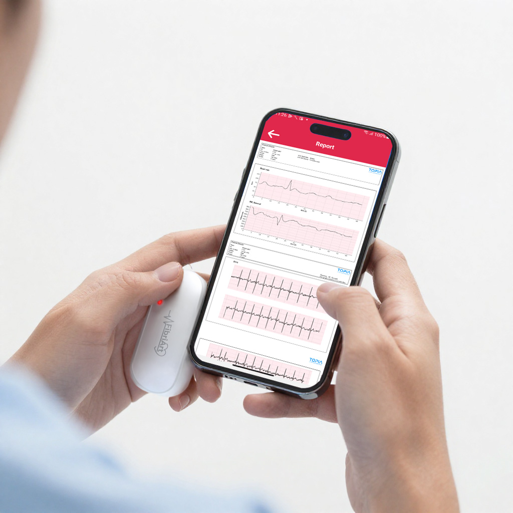 How ECG Monitoring Works: