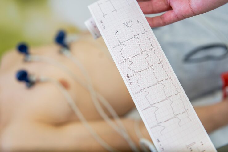 Limitations of Traditional Cardiac Monitoring Devices